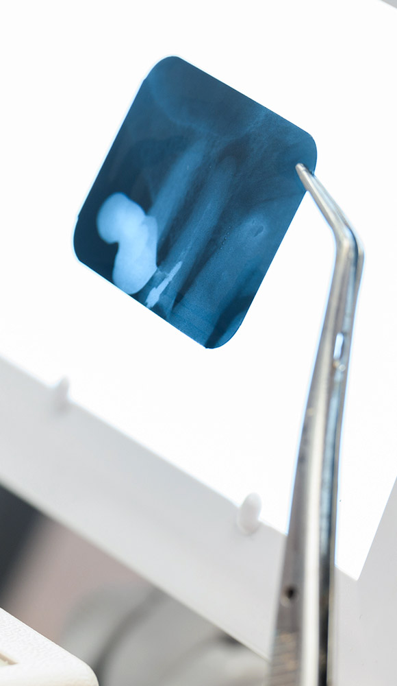 Intraoralni<br>snimak